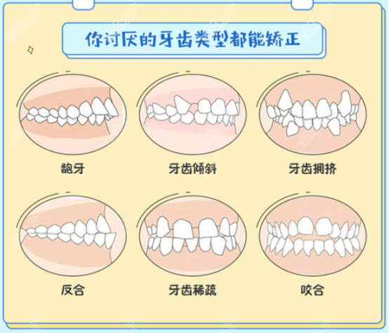 看北大口腔贾绮林正畸怎么样?附上真人实例和出诊时间