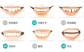 小孩子那个年龄段做牙齿矫正周期短效果好？