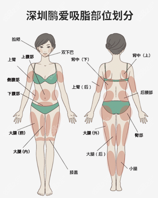 深圳鹏爱吸脂部位划分