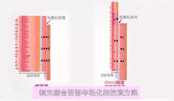 佐尔创美什么原理_明日方舟史尔特尔图片