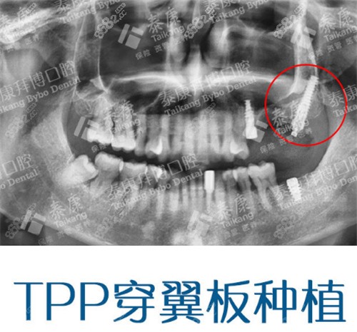 重慶牙科醫院排名前十醫院彙總,分享重慶十大口腔醫院排名!