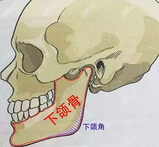 国字脸做下颌角磨骨手术步骤中有说截下颌骨从哪里开刀哦