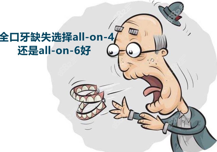 全口牙缺失選allon4還是allon6哪一種修復方式更好