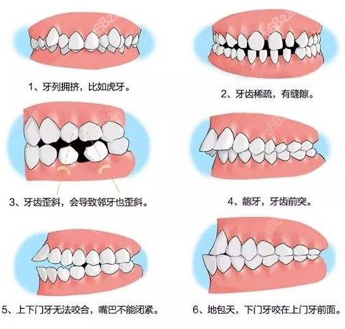 泉州正規牙科醫院排名裡有牙齒矯正好的醫院和收費價格