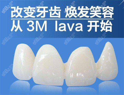 美國3m lava全瓷牙宣傳圖