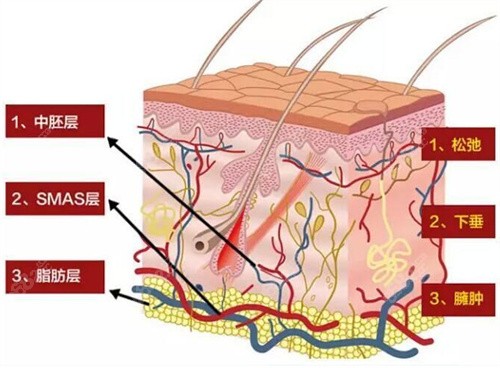 皮膚組織示意圖