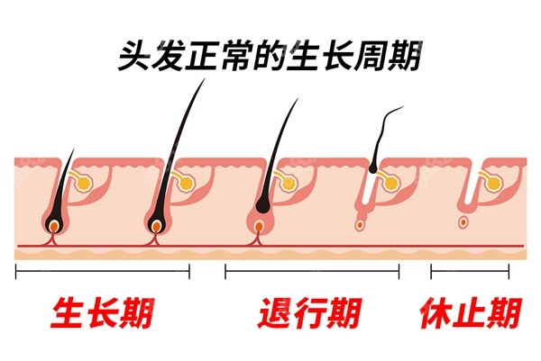 非那雄胺為什麼可以治療脂溢性,遺傳性脫髮?