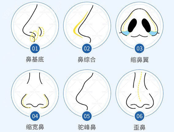 北京吴玉家在那个医院坐诊找他做鼻子来联合丽格就可以