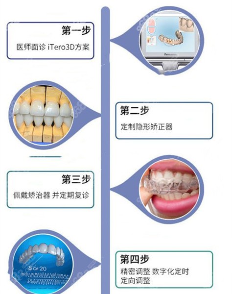 牙齿矫正的过程带图解图片