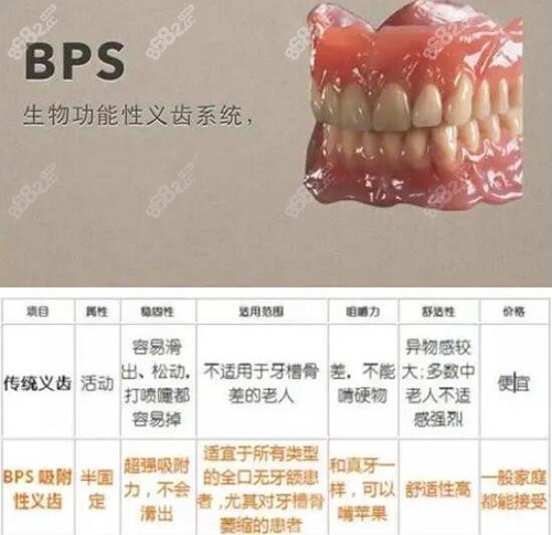 吸附性義齒價格收費標準已公佈快看半口全口bps義齒價格