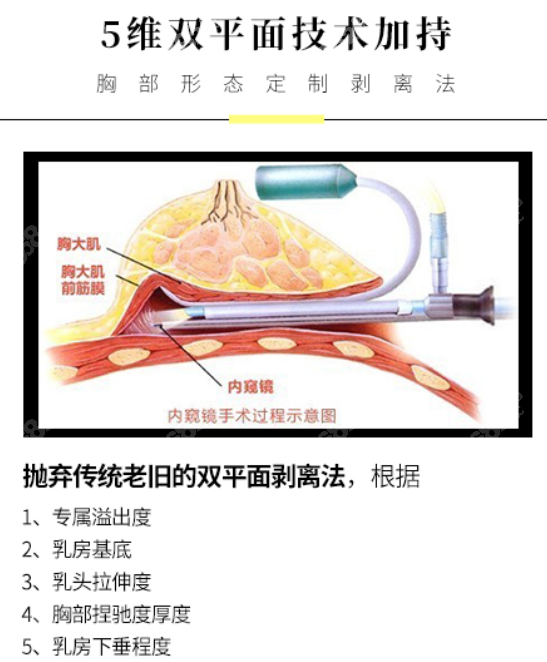 五維雙平面技術